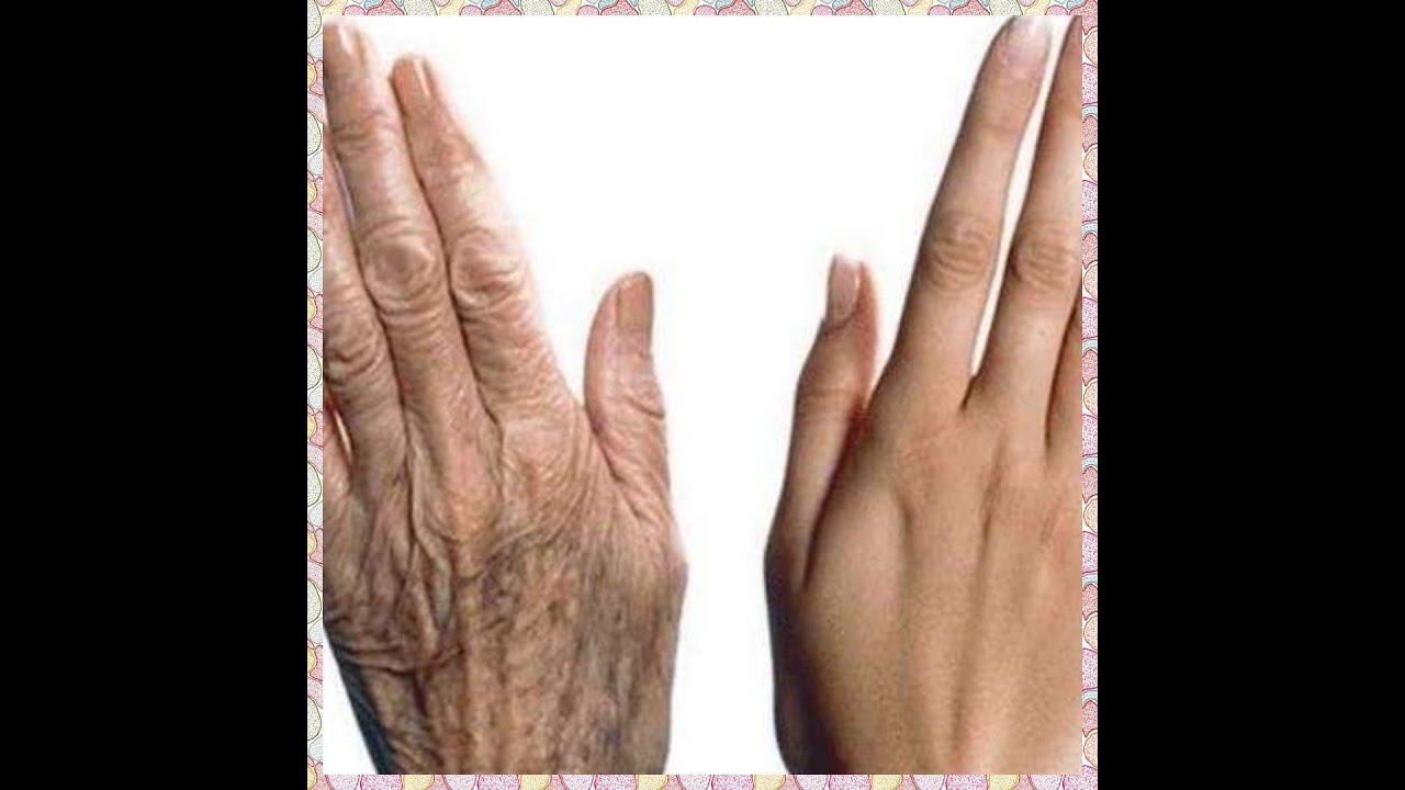 Как ОМОЛОДИТЬ ДРЯБЛЫЕ и " УБИТЫЕ" руки . смотреть онлайн