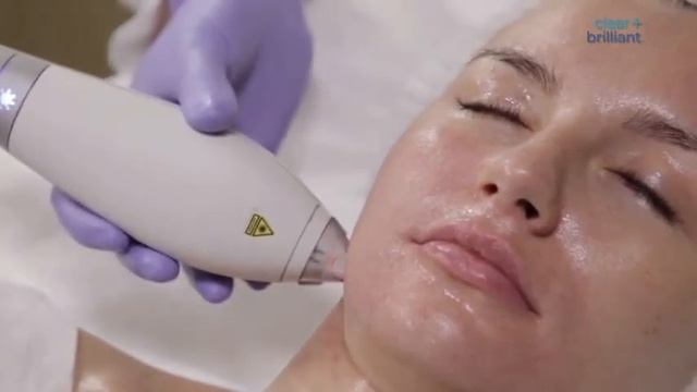 Finepeel мастер класс смотреть онлайн