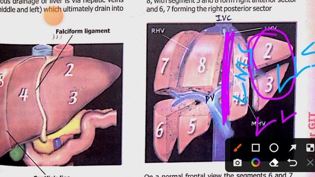 Upper GIT Surgery 10 | Liver Anatomy,Functions, Assessment of Liver Functions & Cholestasis смотреть онлайн