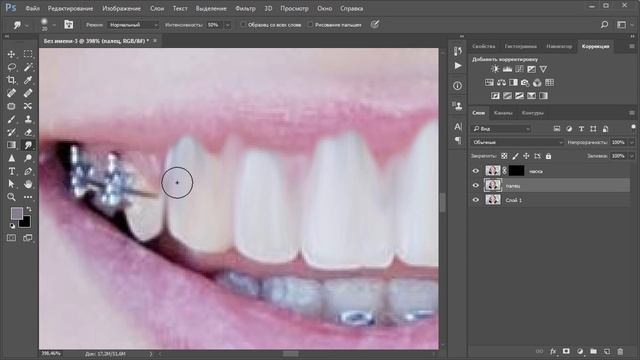 Убираем брекеты в photoshop смотреть онлайн