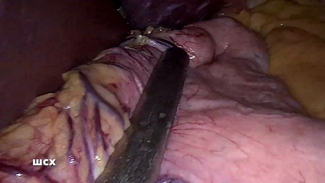 Sleeve+D'or смотреть онлайн