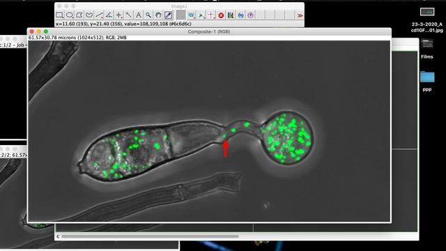 How to add arrow to image in ImageJ (arrow annotation) смотреть онлайн