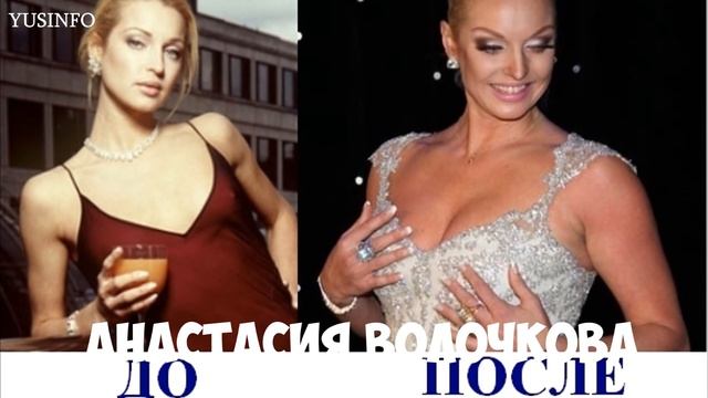 Звезды ДО и ПОСЛЕ пластики. Российский Шоу-бизнес