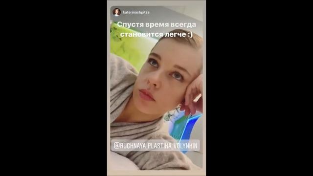 Катерина Шпица в Центре Ручная Пластика® смотреть онлайн