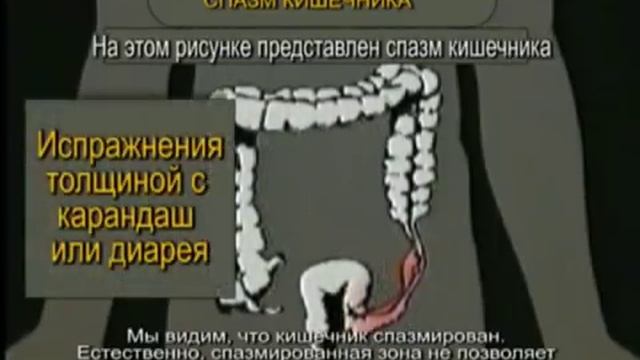 Очищение организма. Кишечник. Пять систем выведения. Это должен знать каждый! смотреть онлайн