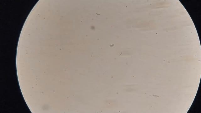 Влияние РИСА на кровь. Итоги смотреть онлайн