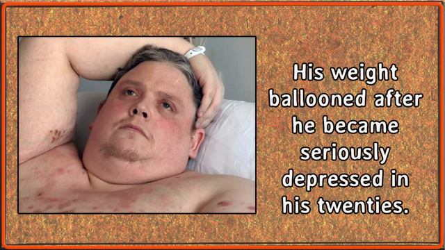 The Sad Truth About Morbid Obesity смотреть онлайн