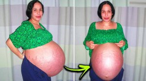 Самые Необычные Случаи Беременности