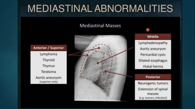 chest X ray, what to look for, part IV смотреть онлайн