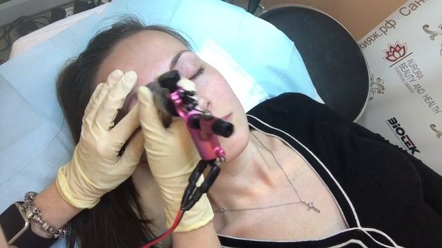 Удаление татуажа ремувером смотреть онлайн