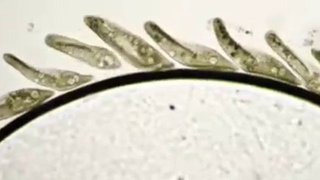 Наблюдение за жизнью инфузорий туфелек под микроскопом смотреть онлайн