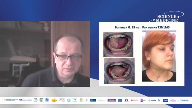 Опухоли головы и шеи: новое в диагностике и лечение смотреть онлайн