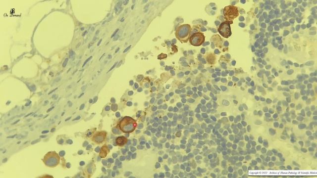 Histology of Lymph nodes смотреть онлайн