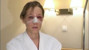 Ринопластика (пластика носа) и септопластика