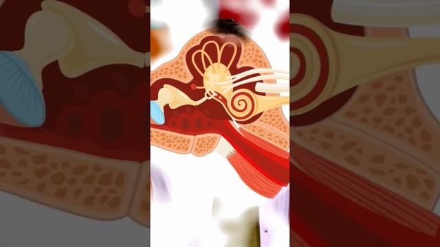 Как развивается отит? #здоровье #доктор #дети #рекомендации #отит #уши смотреть онлайн