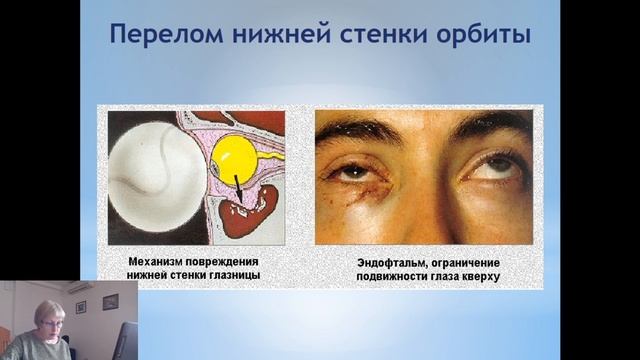 Stgmu смотреть онлайн