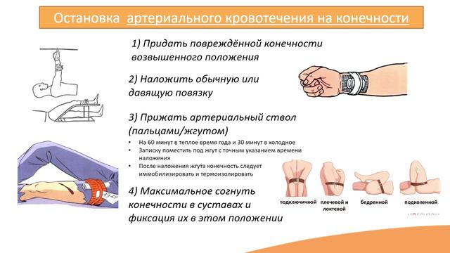 9.2. Методы остановки кровотечений смотреть онлайн