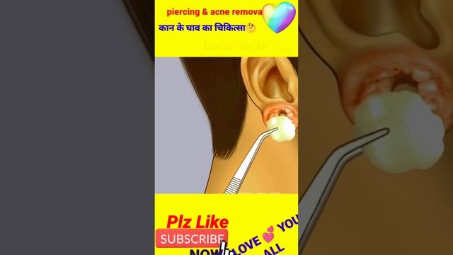 ASMR Cleaning Big Hole Swollen Ear Piercings For A Biker #shorts #viral #viralasmrcleaner665k #asmr