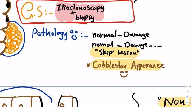 Internal Medicine- GIT - Inflammatory bowel disease part 1 ( Crohn's ) смотреть онлайн