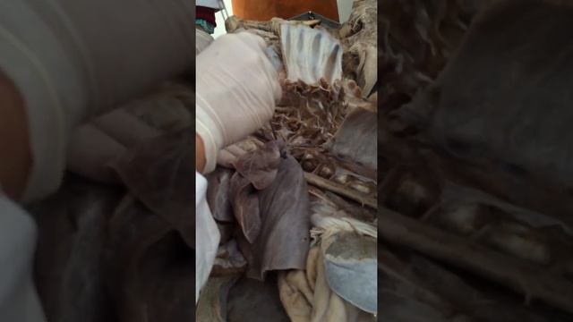 Лимфатические узлы 2 смотреть онлайн