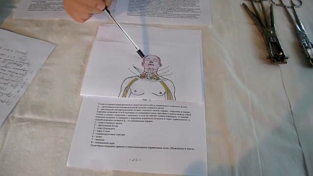 О реальности пересадки головы на донорское туловище (часть 1) смотреть онлайн
