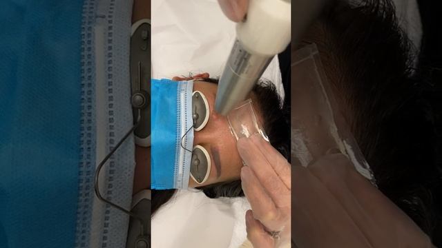 Laser tattoo removal - Permanent Makeup Eyebrow смотреть онлайн