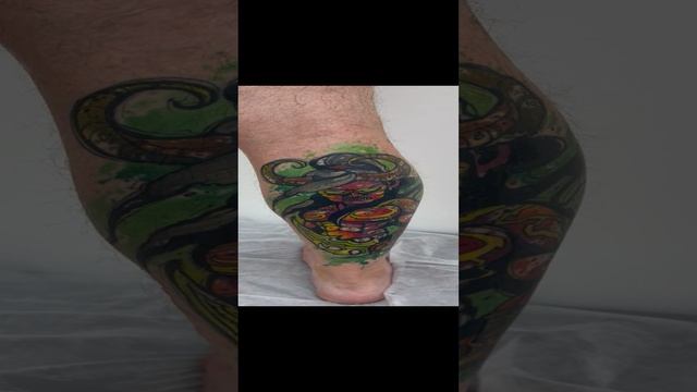 Диагноз ошибочно поставлен. Тромба нет. Флеболог Москва смотреть онлайн