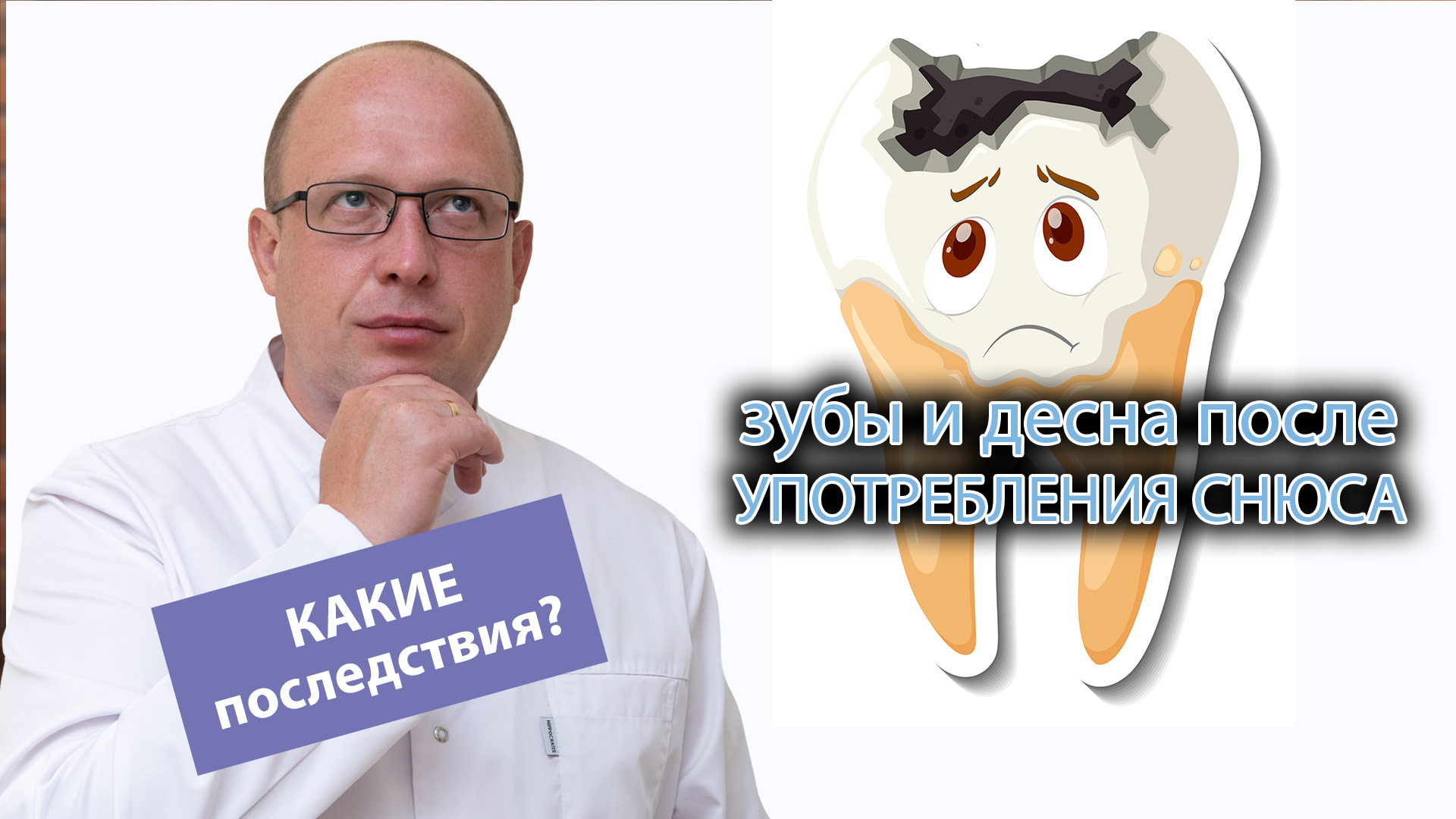 ❓ Что бывает с зубами, деснами и сердцем после употребления снюса? ❌ смотреть онлайн