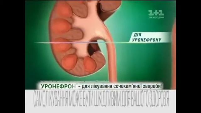 Уронефрон смотреть онлайн