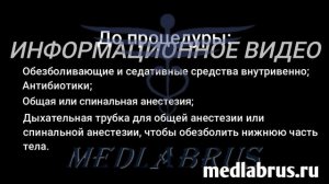 Простата: функции, заболевания и важность диагностики