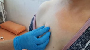 030. Промывание подкожного венозного порта