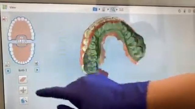 NEW iTero 5D scanner makes dentist appointments faster, more comfortable, and less stressful! смотреть онлайн