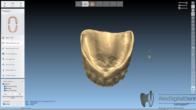 Сканирование съемных протезов и создании модели Meshmixer & 3shape смотреть онлайн
