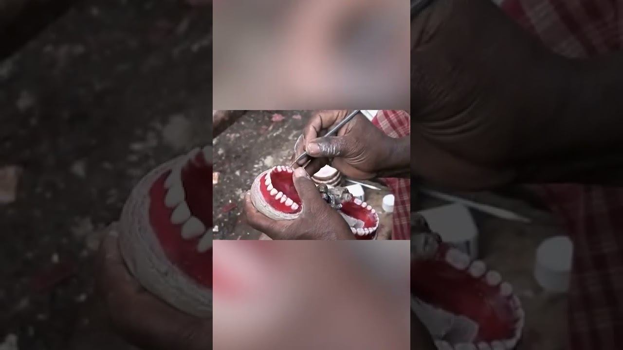 Дикая стоматология в Индии смотреть онлайн