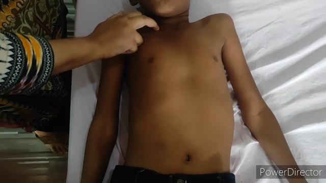 Respiratory System Examination | Pediatrics смотреть онлайн