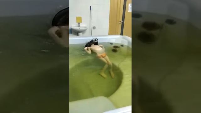 Трудовые дни ребёнка с ДЦП смотреть онлайн