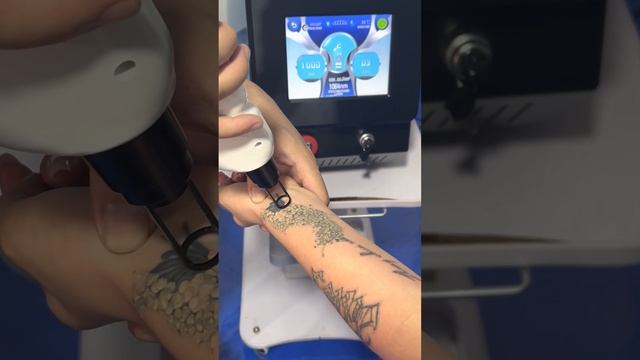 Alma lasers Soprano ICE Platinum Laser Hair Removal Laser Diode 808nm 755nm 1064nm смотреть онлайн