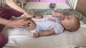 Гимнастика при дисплазии | Широкое пеленание