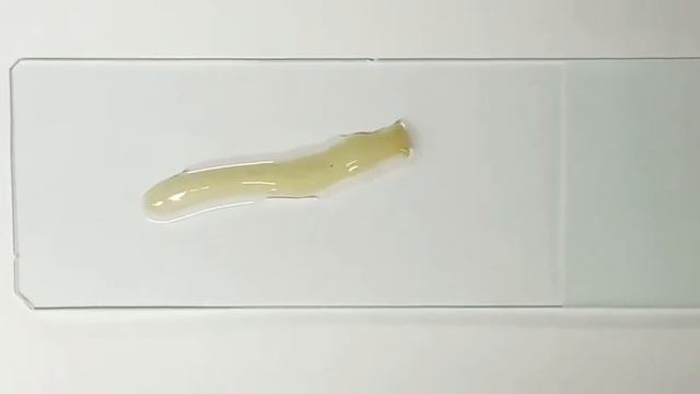 Taenia Saginata Live Movement - Proglottid (beef Tapeworm)