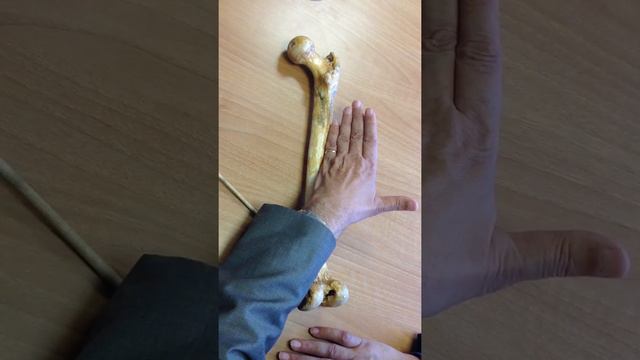 33 practical shaft of femur смотреть онлайн