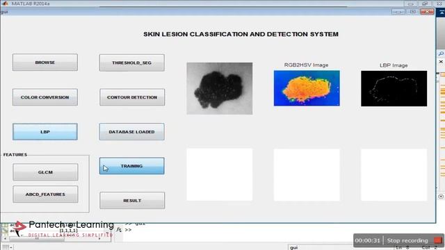 Skin Cancer Detection using the ABCD Rule смотреть онлайн