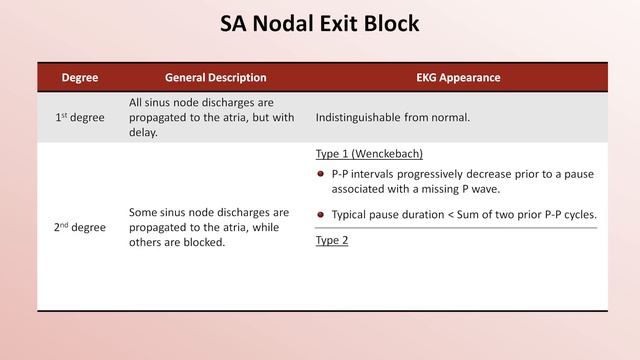 Advanced EKGs - Sinus Node Dysfunction смотреть онлайн