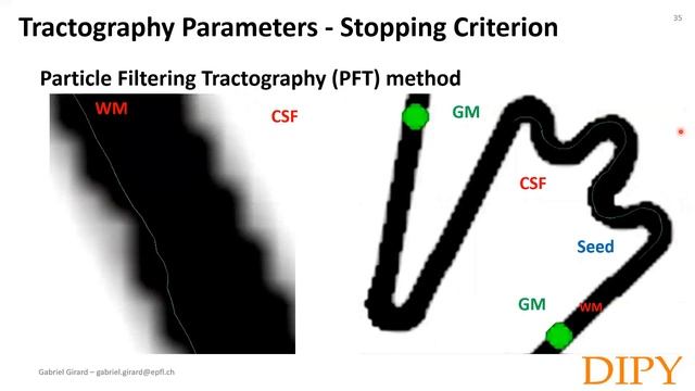 Tractography - Part 2 - State-of-the-Art Streamline Tractography Methods смотреть онлайн