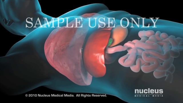 Биопсия печени. смотреть онлайн