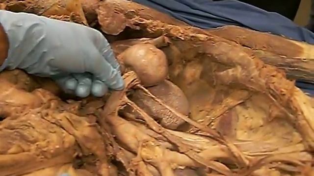 Cadaver for Lab Practical 1 смотреть онлайн