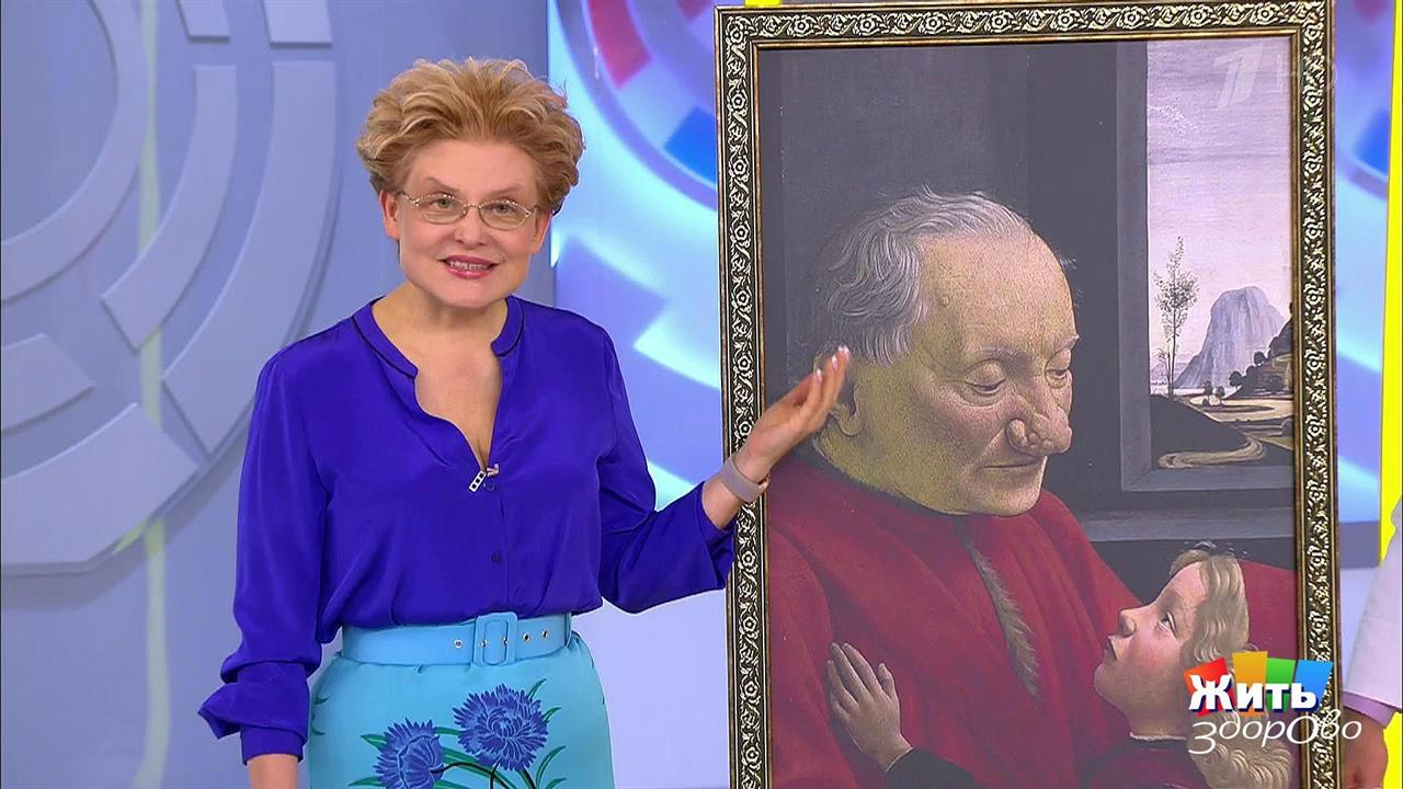 Диагноз по картине. Ринофима. Жить здорово! Фрагмент выпуска от 16.01.2019 смотреть онлайн