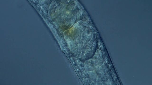 Turbellaria: Gyratrix hermaphroditus смотреть онлайн