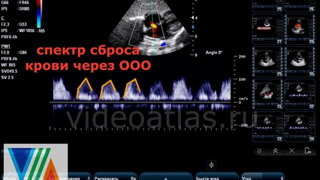 ООО - есть или нет смотреть онлайн