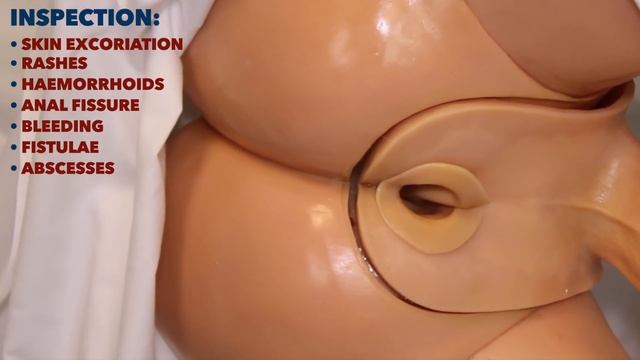 Rectal Examination (PR) - OSCE Guide смотреть онлайн