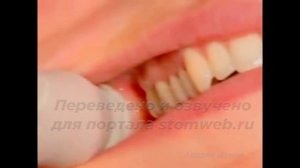 Мандибулярная анестезия.Техника Акинози-Вазирани.